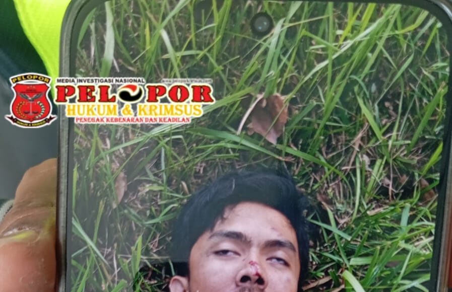 Di Duga Laka Tunggal Korban Mengalami Patah Tulang Leher Bagian Belakang 12 Hari Tidak Sadar, Keluarga Mencari Tahu Penyebab nya